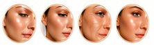 Before and after skin results